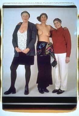 All three. Debbie is exposing a scar on her right breast, just above the neckline of a low cut blouse. Carol is without a shirt, to expose her reconstructed right breast. Libby is wearing a red turtleneck.